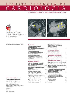 Volumen 60. Número 1