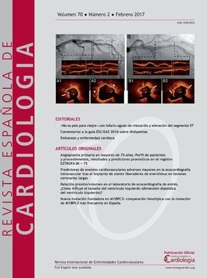Volumen 70. Número 2