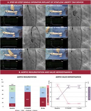 Graphical Abstract Single-operator implantation of the new generation...