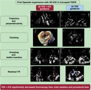 Graphical Abstract Transcatheter edge-to-edge tricuspid valve repair ...